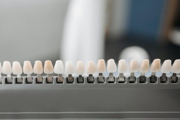 Fatete dentare pentru un aspect atragator si permanent