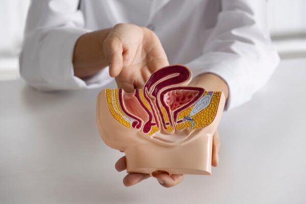 Cancerul Colorectal