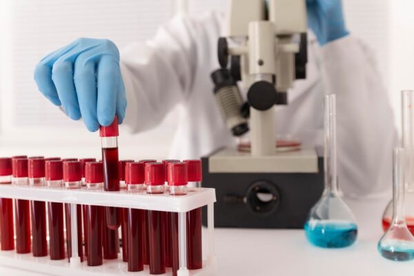 Cancer de sânge: tipuri, simptome, factori de risc și metode de diagnostic